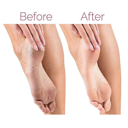 DealX™ Electric Foot Callus Remover – Rechargeable Pedicure Tool